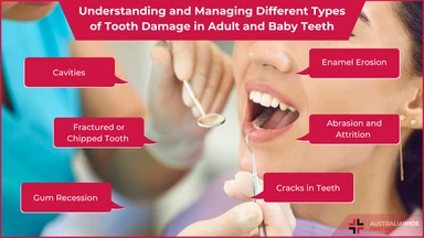 Tooth damage article header